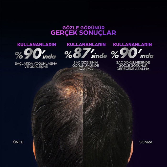 Clear Men Scalp Pro Saç Dökülme Karşıtı Güçlendirici Serum 70 Ml - 3