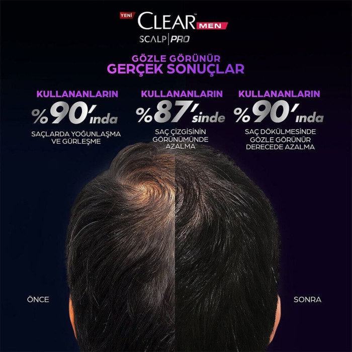 Clear Men Scalp Pro Saç Dökülme Karşıtı Şampuan 300 Ml - 5