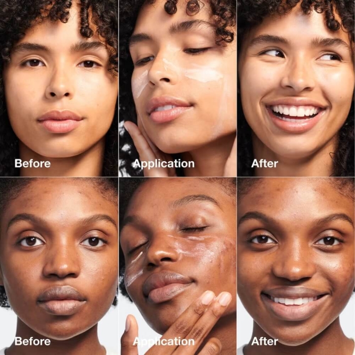 Clinique Moisture Surge Meets Set - 5