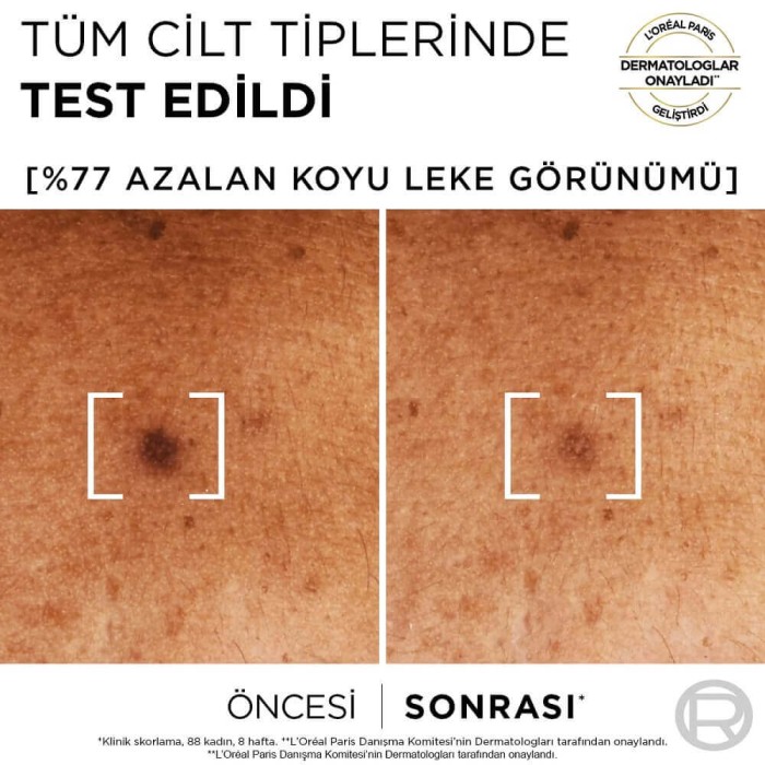 L'Oréal Paris Bright Reveal Sivilce, Güneş, Yaşlanma Lekelerinde Etkili Koyu Leke Karşıtı Serum 10% Niasinamid 30 Ml - 4