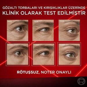 L'Oréal Paris Revitalift Laser Eye Bag Eraser - 10