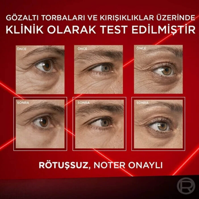 L'Oréal Paris Revitalift Laser Eye Bag Eraser - 10