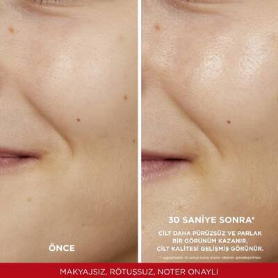 L'Oréal Paris Revitalift Peeling Etkili Tonik 180 Ml - 8