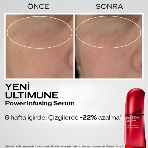 Shiseido Ultimune Power Infusing Concentrate Serum 50 Ml - 5